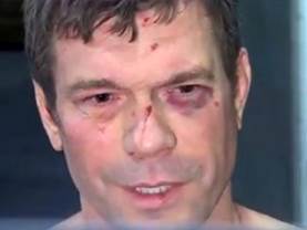 Пресс-служба: Царев в тяжелом состоянии после избиения активистами / ГОРДОН