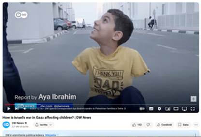 Mahmud, il bambino palestinese senza le braccia