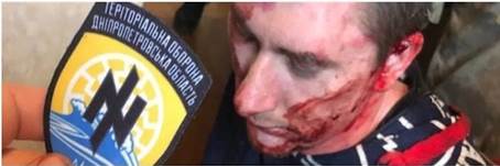 |  Sopra La tortura dell'attivista di sinistra Alexander Matjuschenko il 3 marzo a Dnipro registrata da membri dell'Azov Sotto Il presidente Volodymyr Zelensky posa durante un impegno con i media |  Signor in linea
