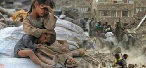 Risultato immagini per Yemen children